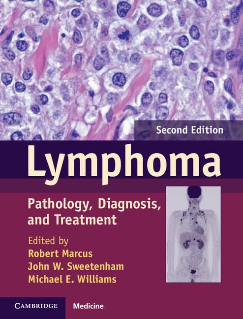 lymphoma: pathology, diagnosis, and treatment