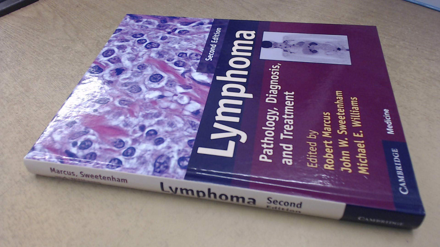 myeloma: pathology, diagnosis, and treatment