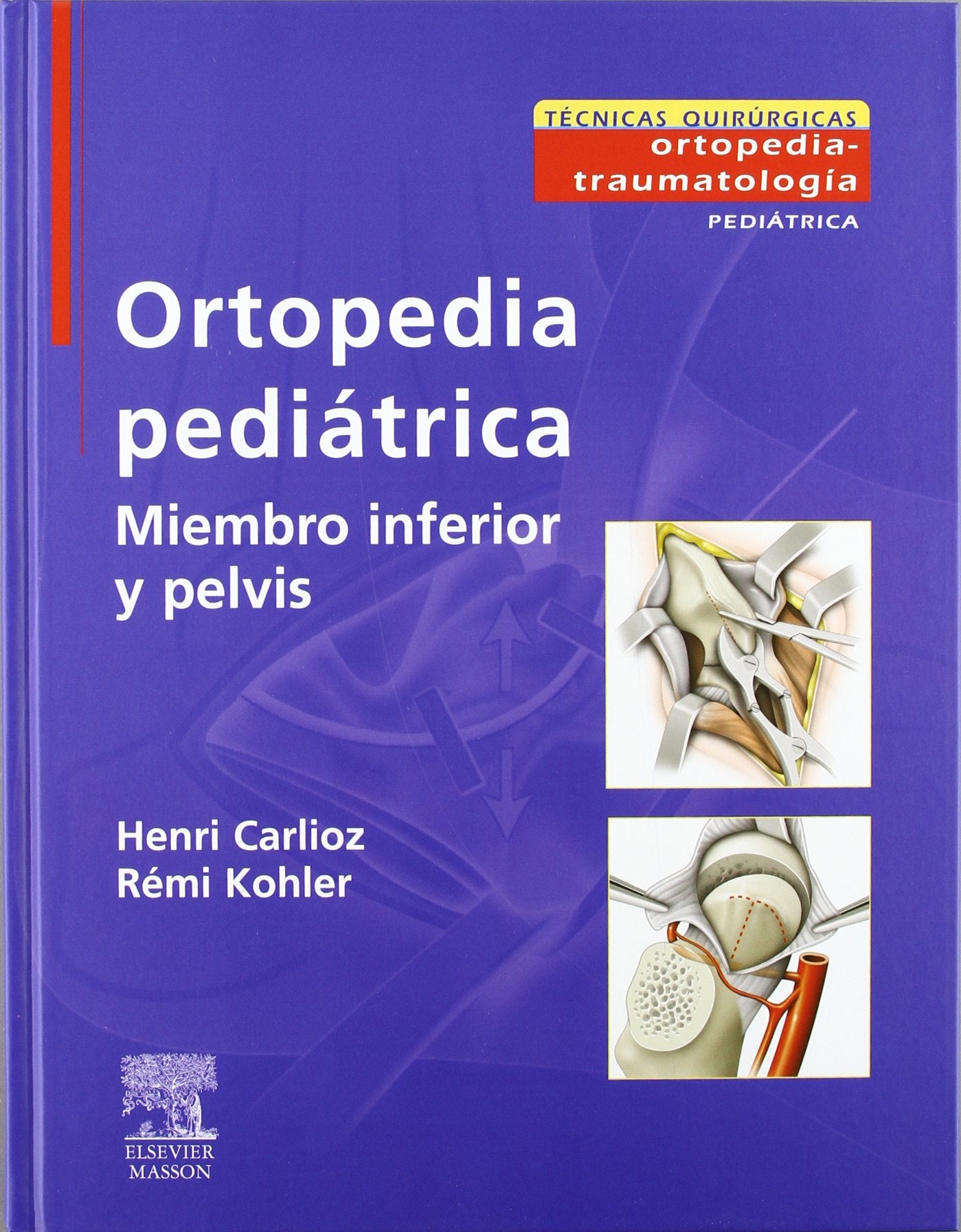 ortopedia pediátrica. miembro inferior y pelvis